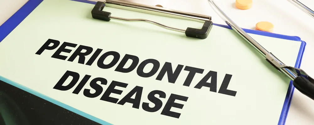 PERIODONTAL DISEASEと書かれた診察記録のボード｜シティデンタルクリニック ペリエ千葉エキナカ